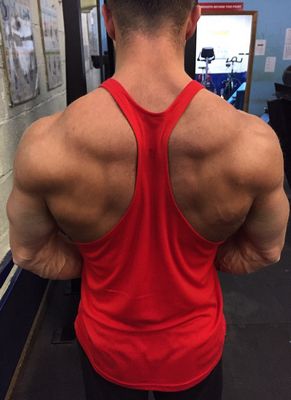 Trenbolone Acetate bodybuilding
